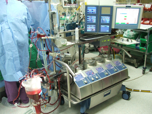 Herz- Lungen Maschine
